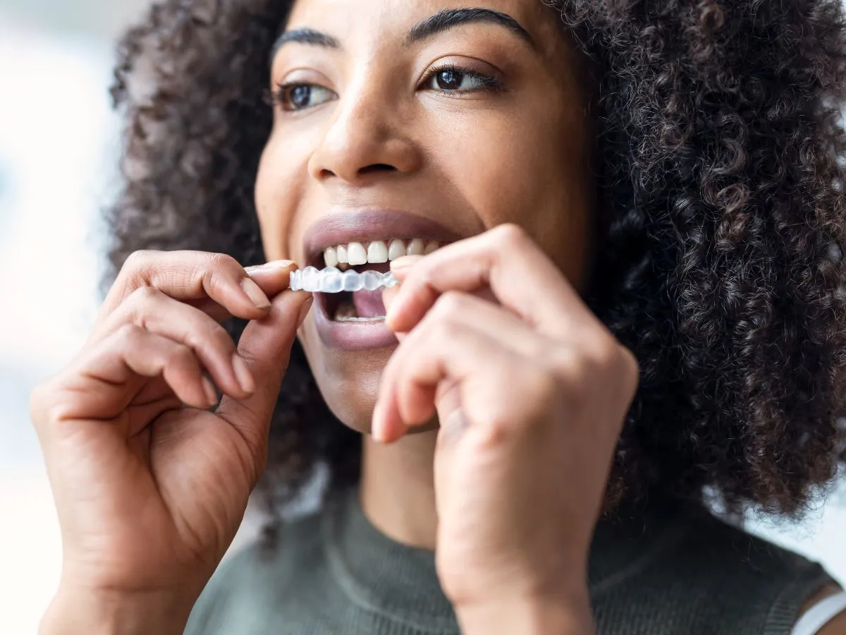 clear aligners at Bethesda Dental Associates